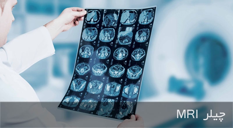 چیلر MRI |  نقش چیلر در دستگاه  MRI